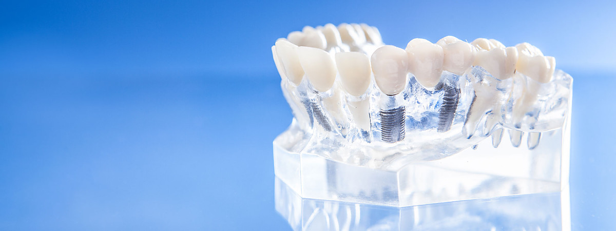 Dentallabor Pirina Dental