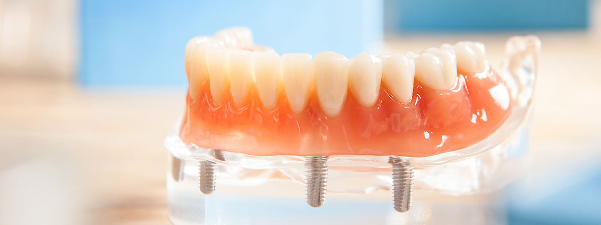 Dentallabor Pirina Dental