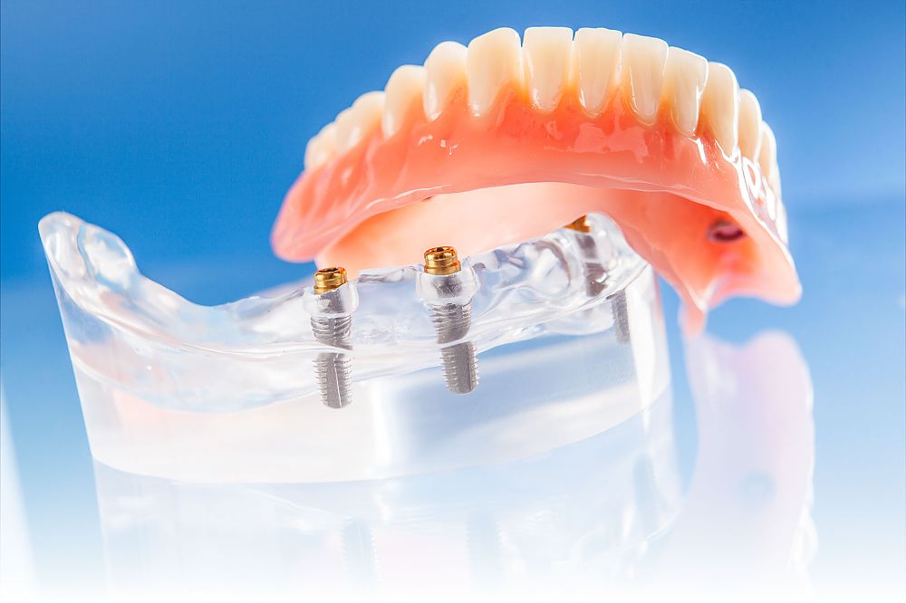 Service für Zahnärzte